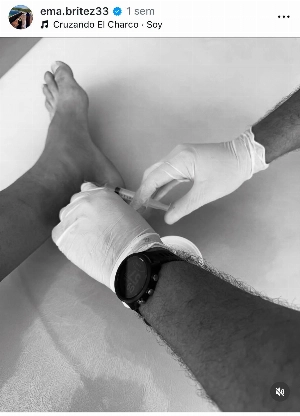 ge - Brítez revela que jogou final do Cearense lesionado: 