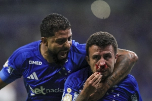 ge - Matheus Henrique fratura o nariz em lance de gol do Cruzeiro e fica sangrando; veja